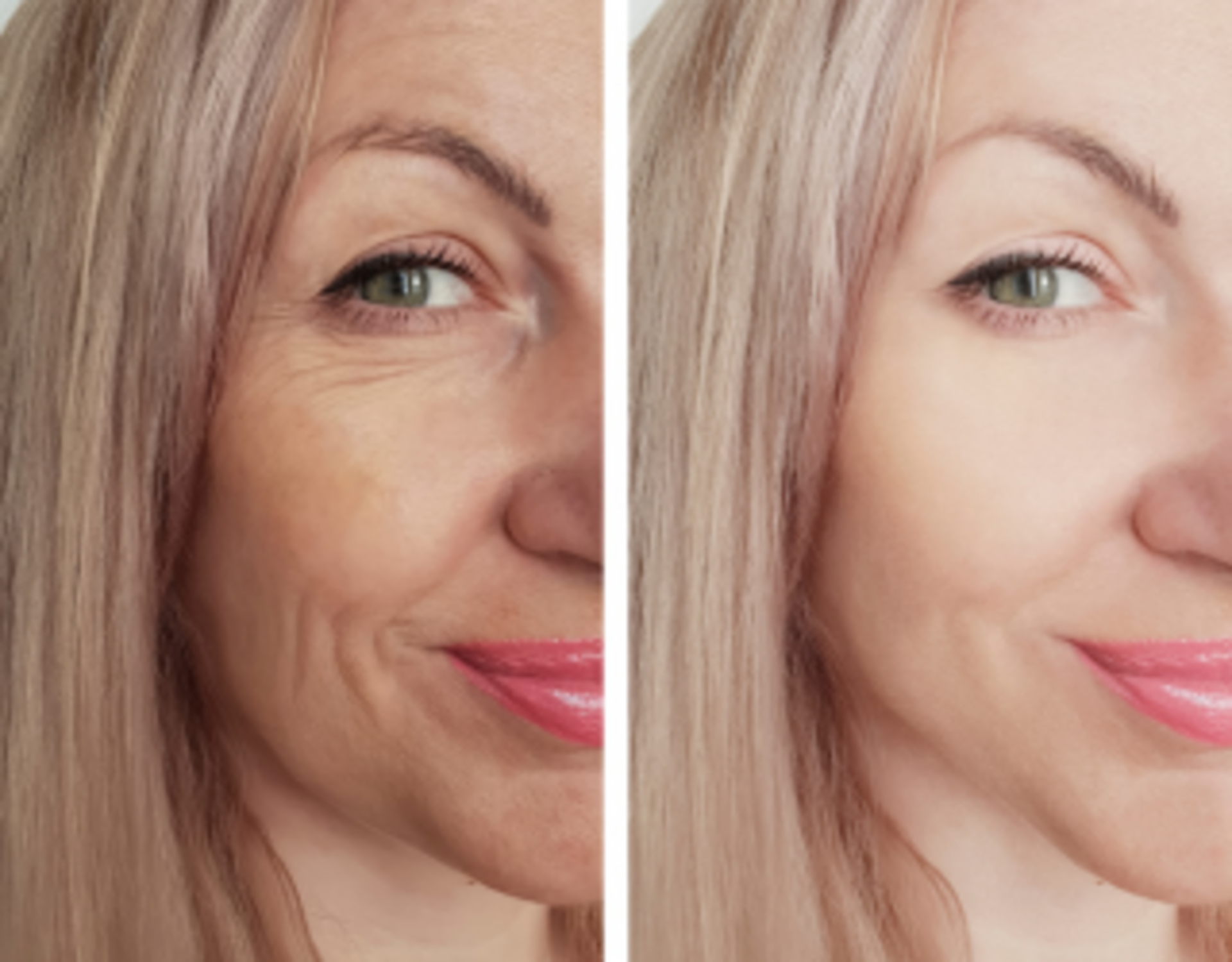 Jaw Surgery