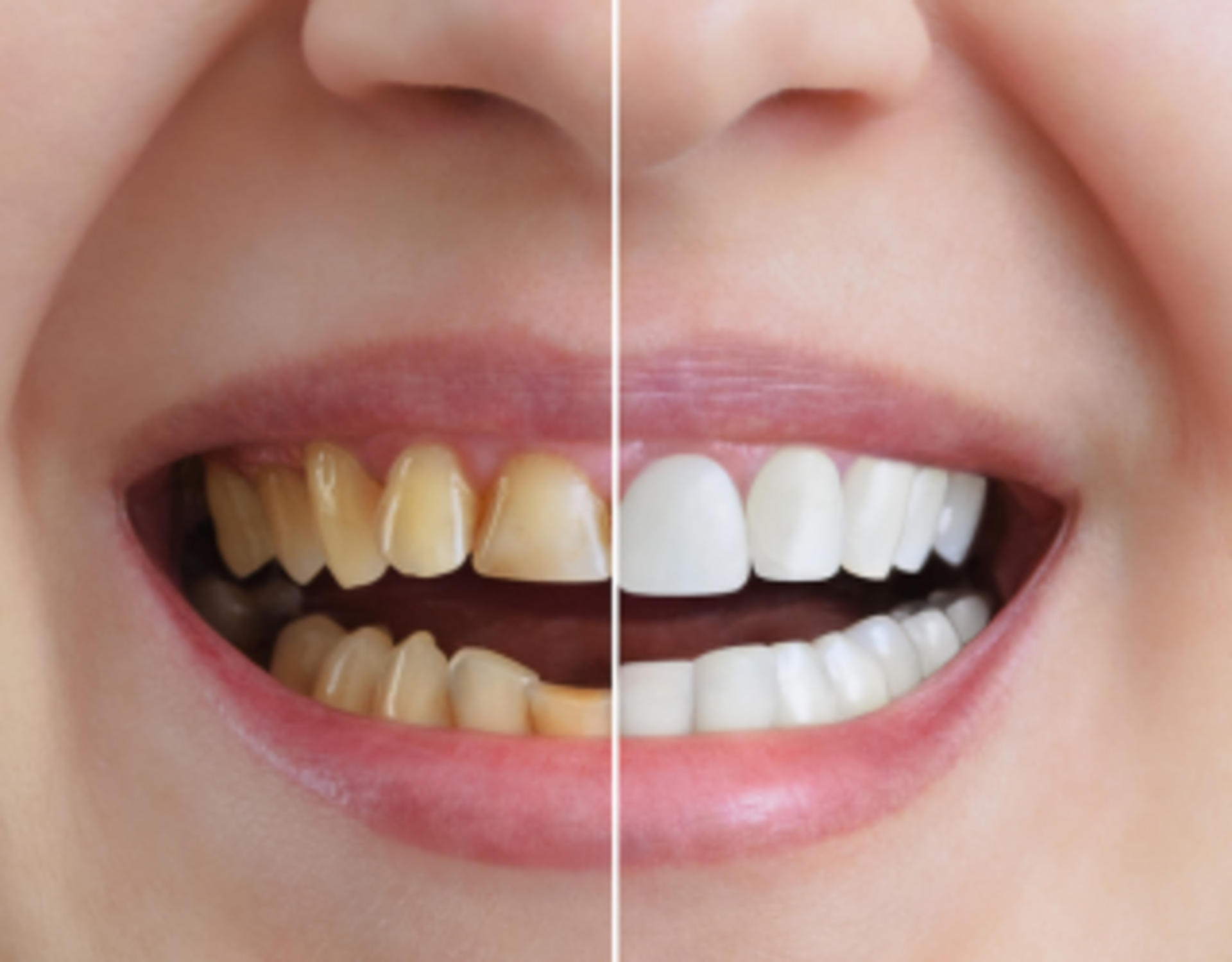 Esthetic Dentistry